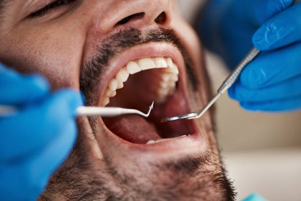 Best Emergency Tooth Extraction in Alexander, AR