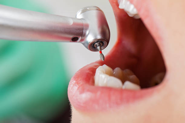Best Pediatric Emergency Dentist in Alexander, AR